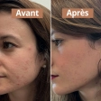 Sérum visage anti-imperfections Comme Avant